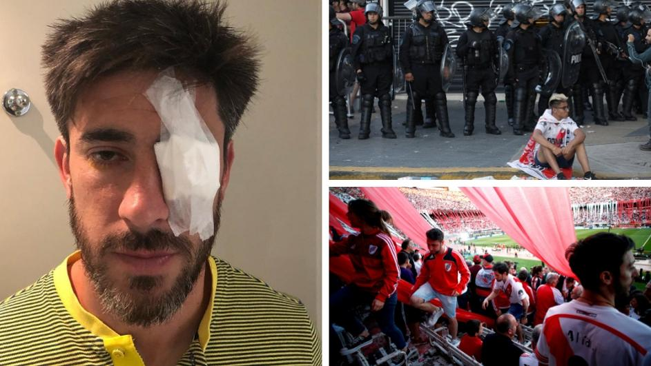 УЖАСНЕ СЦЕНЕ ИЗ БУЕНОС АЈРЕСА: Каменовање. сузавац и насиље, па ово није фудбал, ово је рат (ФОТО)